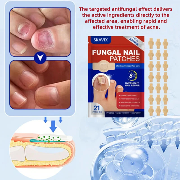 🔥SKAVIX™Fungal Nail Patches, 21pcs/box Nail Health Care Patches, Nail Fungus Care Patches, Suitable for Solving Fungal Nails and Other Nail Problems, Nail Supplies, Daily Care Nails Kit Set