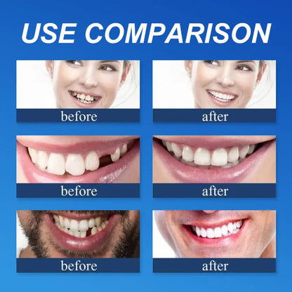 (𝗔𝗳𝗳𝗼𝗿𝗱𝗮𝗯𝗹𝗲 𝗕𝗲𝗮𝘂𝘁𝘆🧏‍♀️🧏‍♂️)--𝗗𝗜𝗬𝗦𝗧𝗔𝗥™ --𝗔𝗱𝘃𝗮𝗻𝗰𝗲𝗱 𝗖𝘂𝘀𝘁𝗼𝗺𝗶𝘇𝗲𝗱 𝗙𝘂𝗹𝗹 𝗗𝗲𝗻𝘁𝘂𝗿𝗲 𝗦𝗲𝘁🦷