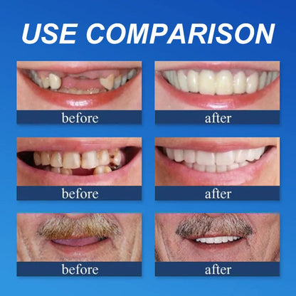 (𝗔𝗳𝗳𝗼𝗿𝗱𝗮𝗯𝗹𝗲 𝗕𝗲𝗮𝘂𝘁𝘆🧏‍♀️🧏‍♂️)--𝗗𝗜𝗬𝗦𝗧𝗔𝗥™ --𝗔𝗱𝘃𝗮𝗻𝗰𝗲𝗱 𝗖𝘂𝘀𝘁𝗼𝗺𝗶𝘇𝗲𝗱 𝗙𝘂𝗹𝗹 𝗗𝗲𝗻𝘁𝘂𝗿𝗲 𝗦𝗲𝘁🦷